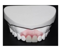 Flexible Partial Dentures for Natural Comfort & Fit