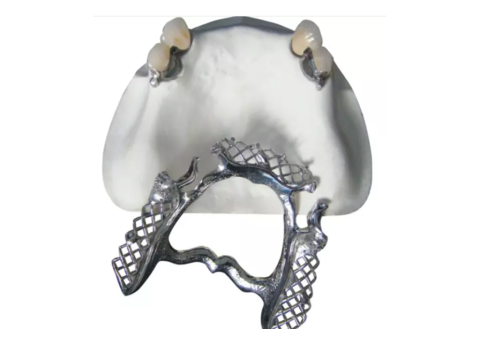 Ball Attachment Systems for Secure Implant Overdentures - 2/2